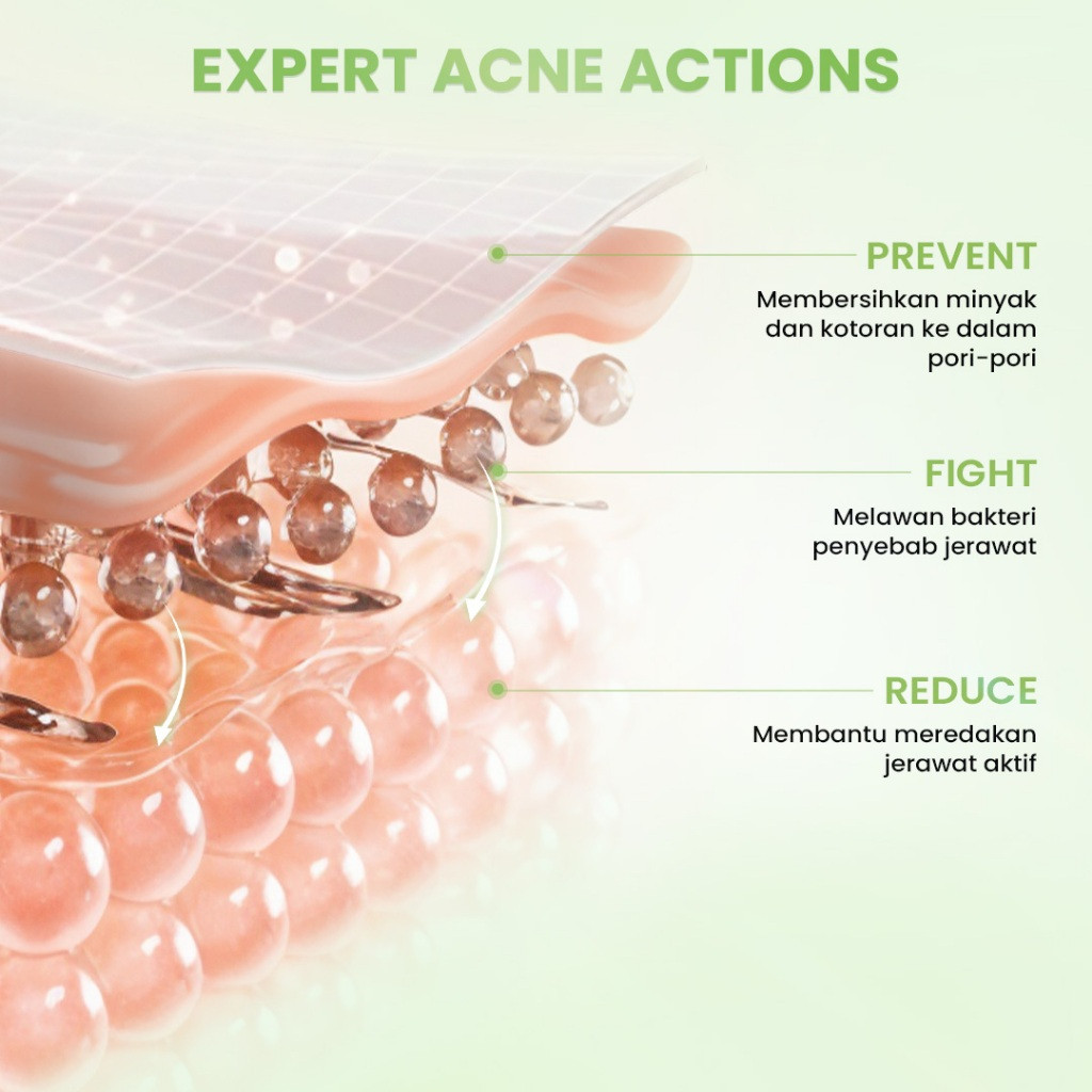 hanasui acne expert night cream 15g/pelembab wajah berjerawat hanasui acne expert night cream 15g/pelembab wajah berjerawat