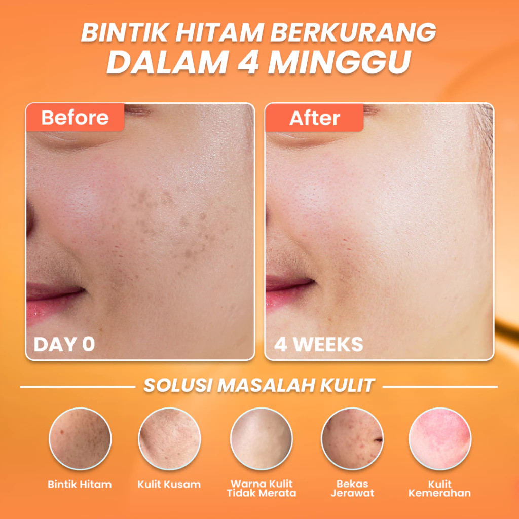 hanasui serum vitamin c 20ml / serum wajah hanasui serum vitamin c 20ml / serum wajah