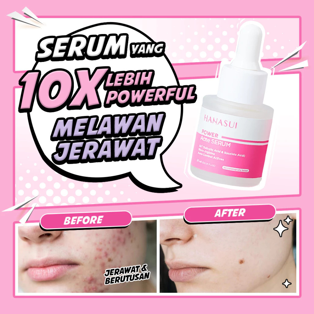 hanasui power acne serum 20ml / serum jerawat hanasui power acne serum 20ml / serum jerawat