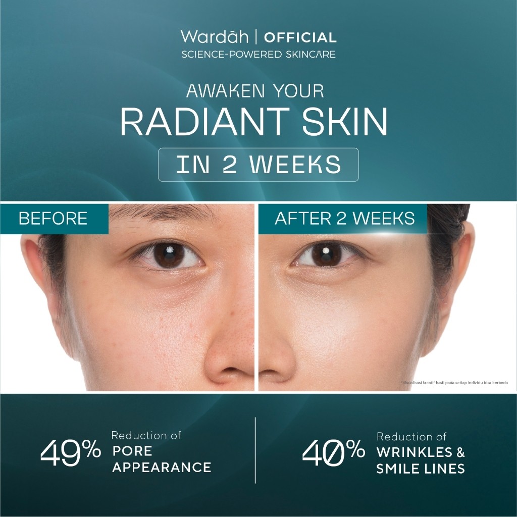 wardah retinal liposome cysteamine radiant resurfacing serum 30ml/serum wajah wardah retinal liposome cysteamine radiant resurfacing serum 30ml/serum wajah