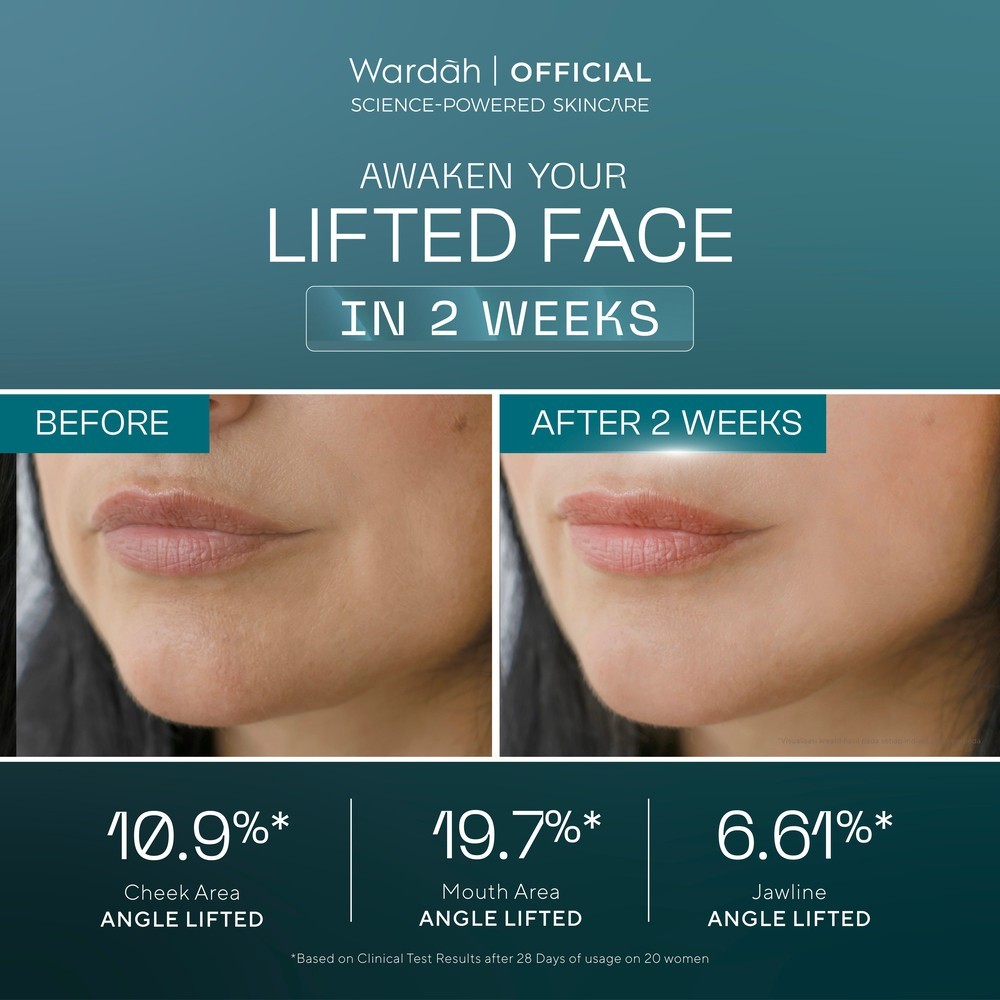 wardah exosome egf pdrn lift regenerating serum 30ml/serum wajah wardah exosome egf pdrn lift regenerating serum 30ml/serum wajah